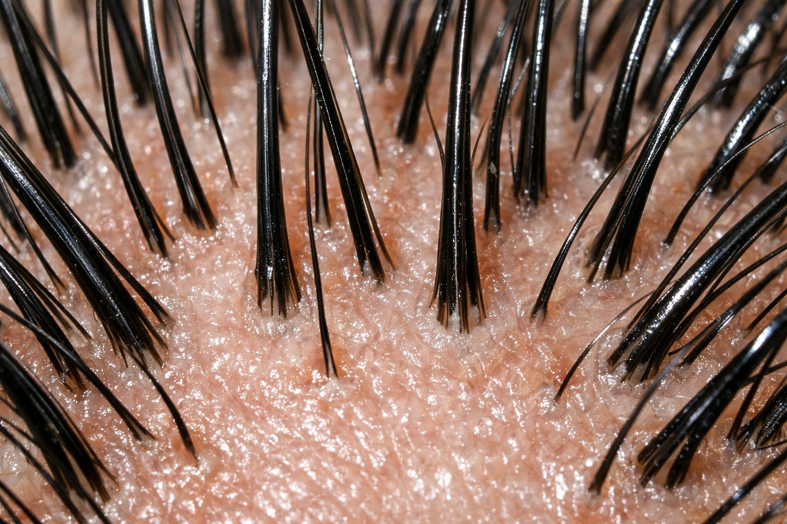 Péče o vlasovou pokožku: Základ zdravých a krásných vlasů